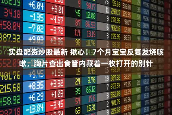 实盘配资炒股最新 揪心！7个月宝宝反复发烧咳嗽，胸片查出食管内藏着一枚打开的别针